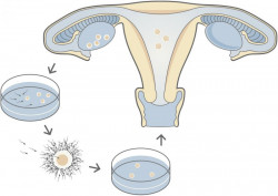 Bildliche Darstellung der IVF